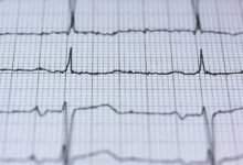 horizon pulse strategic path